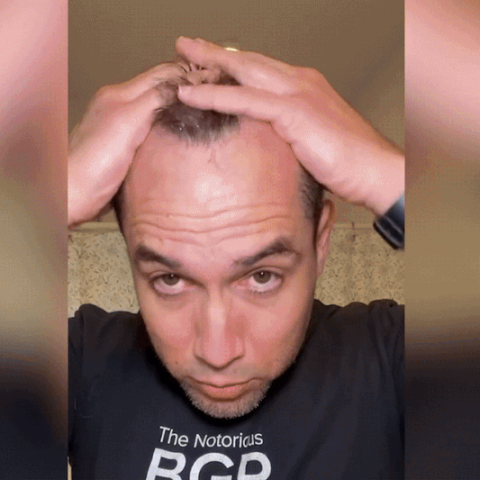 FEG Hair Growth Spray | Desert Deals Hub